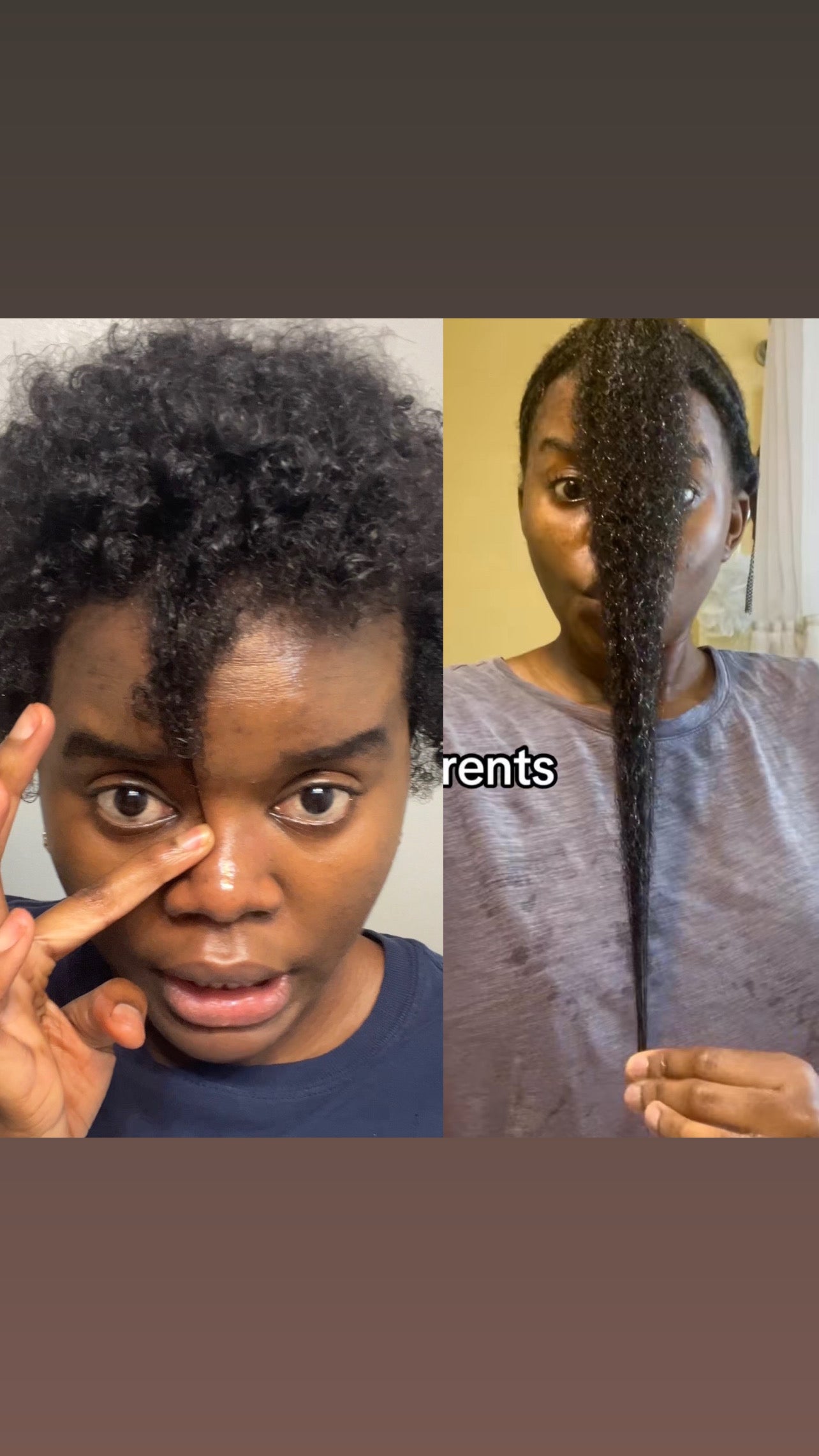 Natural hair growth bundle by Butterbloom featuring scalp care products for intense hydration and healthy hair.