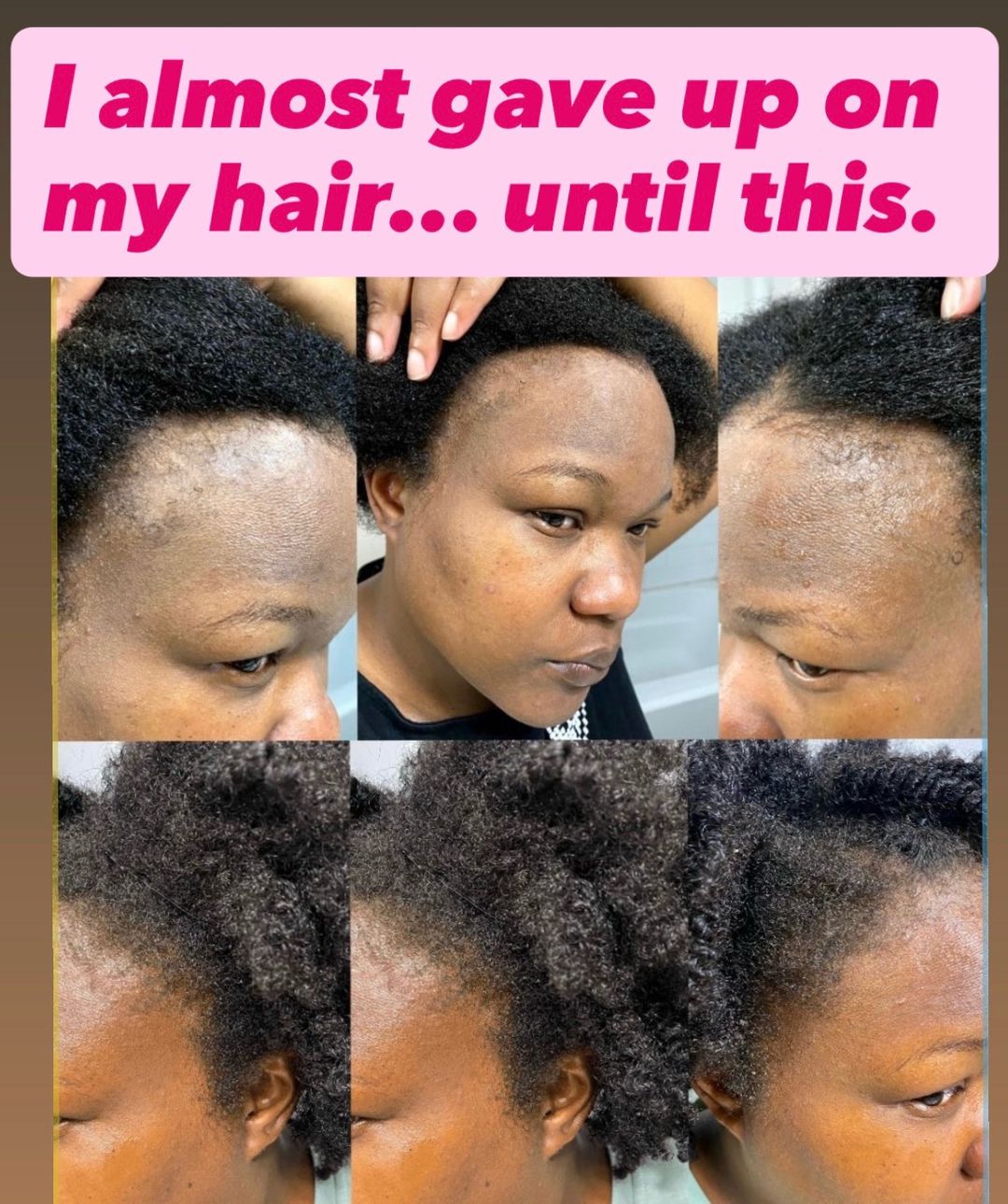 Shea butter, rice water, black soap shampoo, growth oil, and scalp stimulator in a natural hair care bundle by butterbloom.