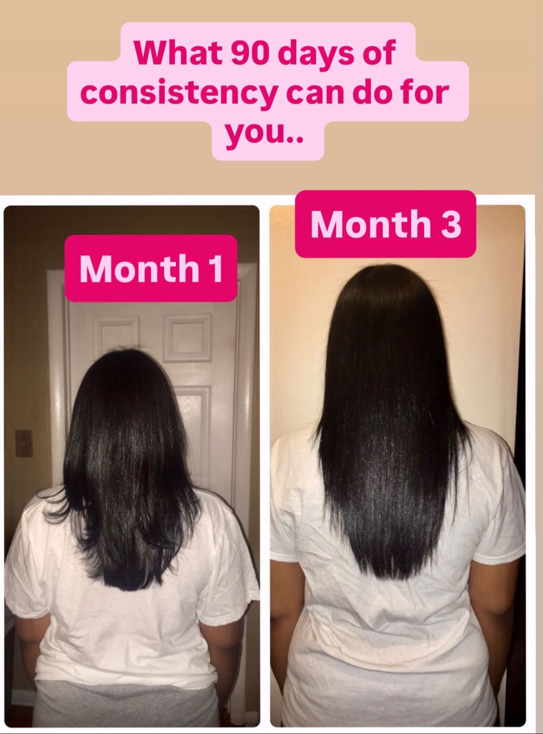 Shea butter, rice water, black soap shampoo, growth oil, and scalp stimulator in Butterbloom natural hair growth bundle.