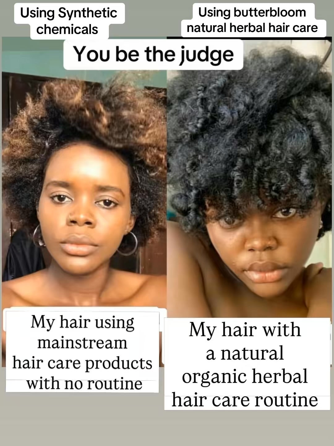 Natural hair Growth Bundle | For Scalp care, Intense Hydration & Healthy hair