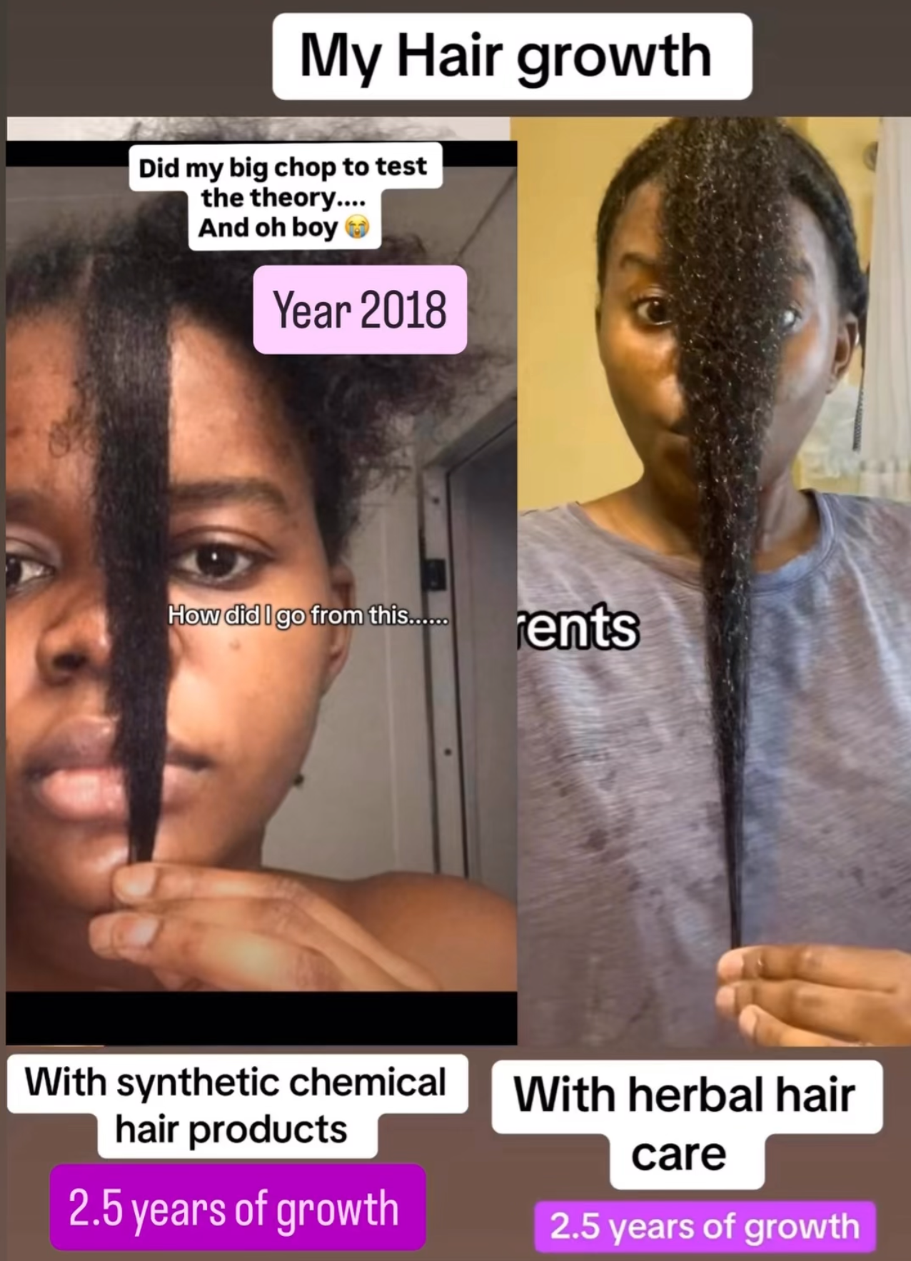 Natural hair Growth Bundle | For Scalp care, Intense Hydration & Healthy hair