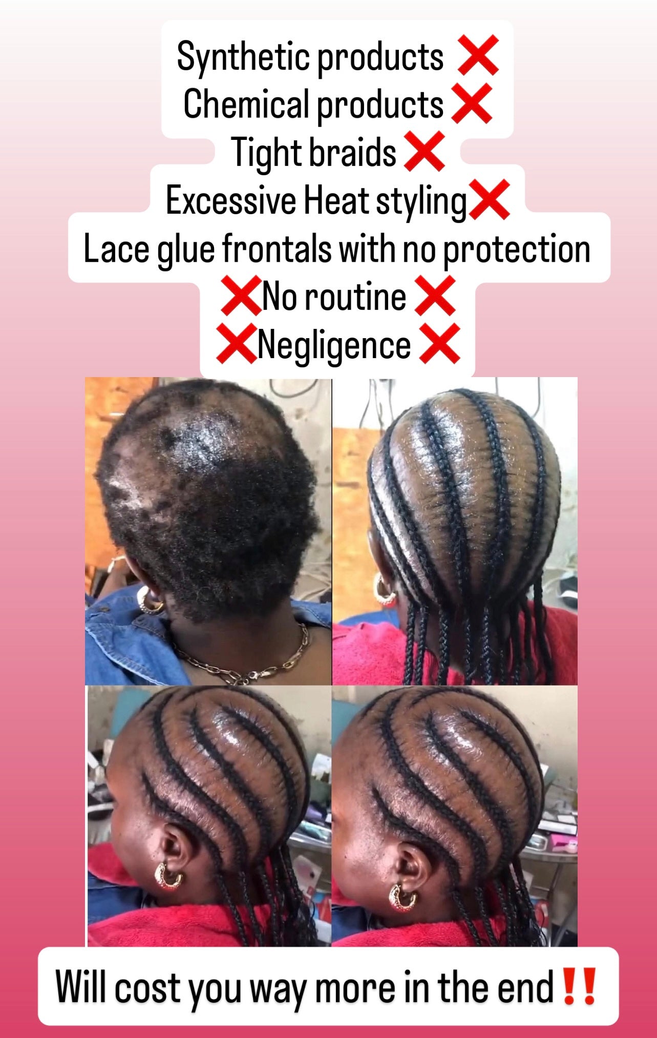 Hair Growth Bundle - Natural Hair Care Routine | Shea butter, Ricewater, African Black Soap Shampoo, Growth oil & Scalp Stimulator